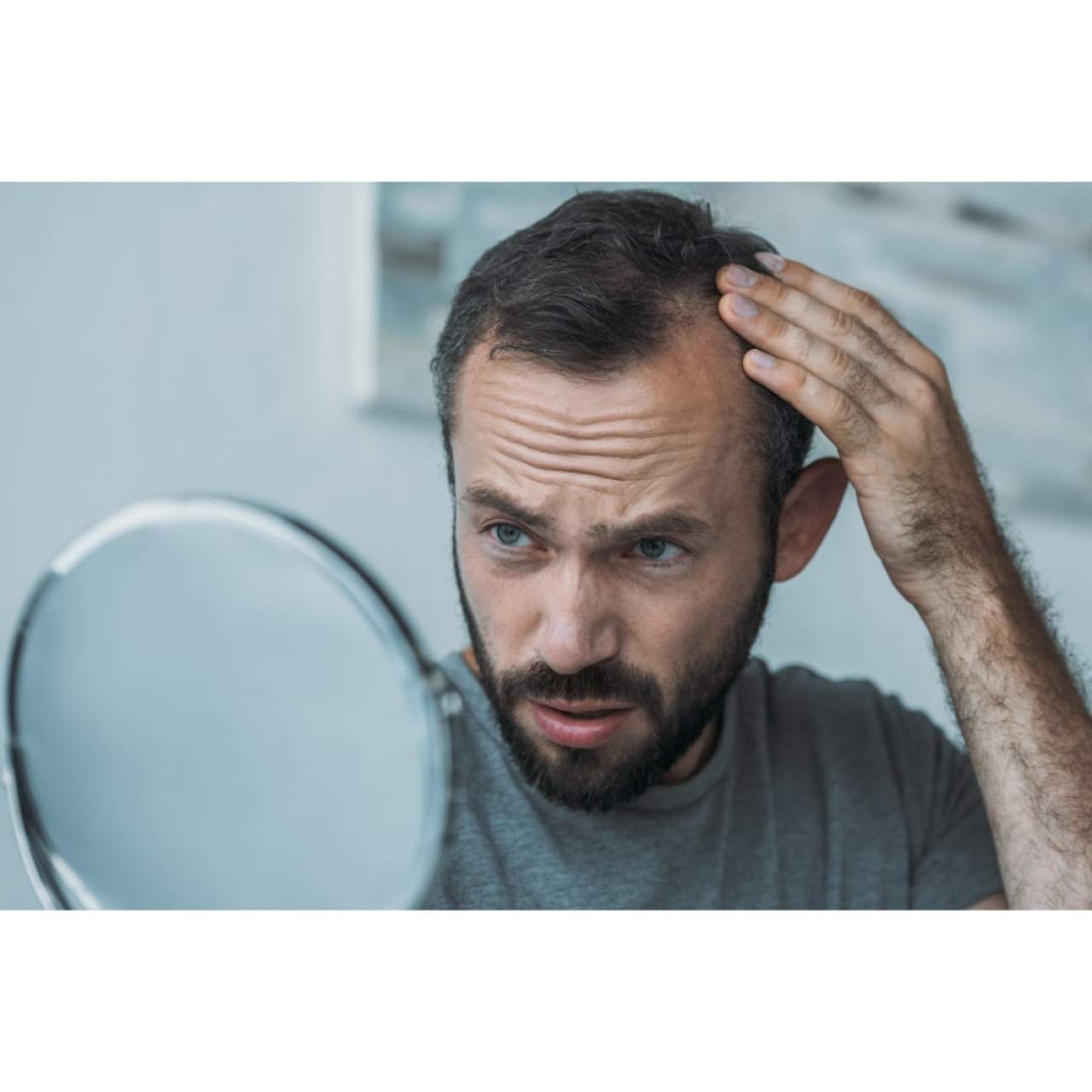 Prevenir la caída del cabello en Barcelona: Dr. Carlos Zito