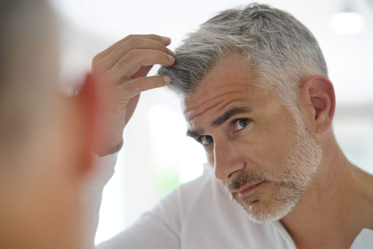 Empresas especializadas como My Special Hair: ¿Son las prótesis capilares a medida el futuro?
