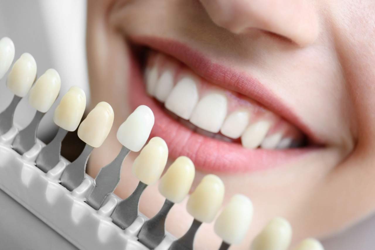 Clínica dental Helident en Sevilla: búsquedas acerca de los implantes dentales en Sevilla