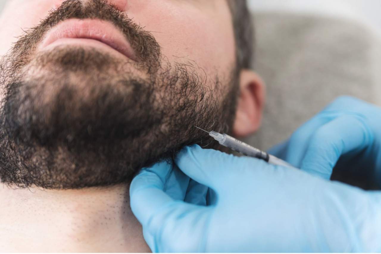 Dr. Carlos Zito y su masculinización facial