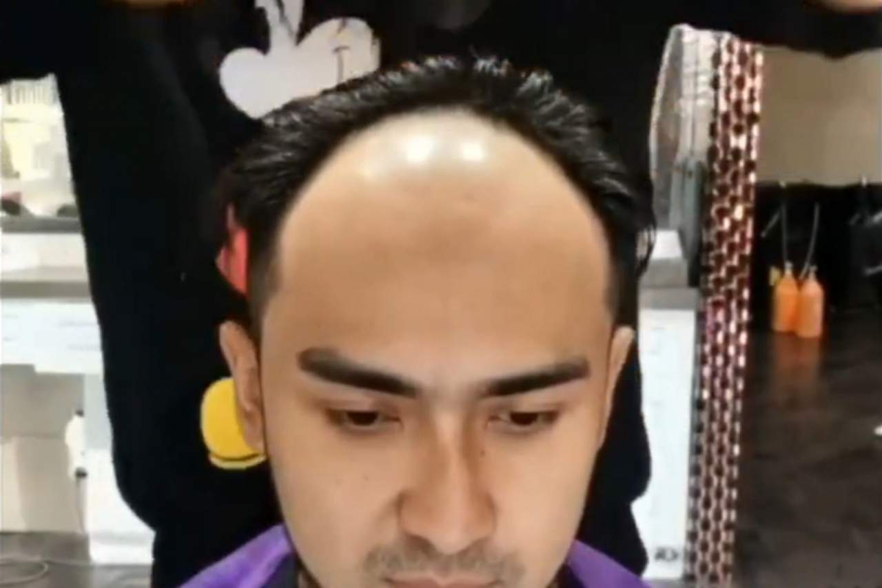 Prótesis capilares para hombre de My Special Hair