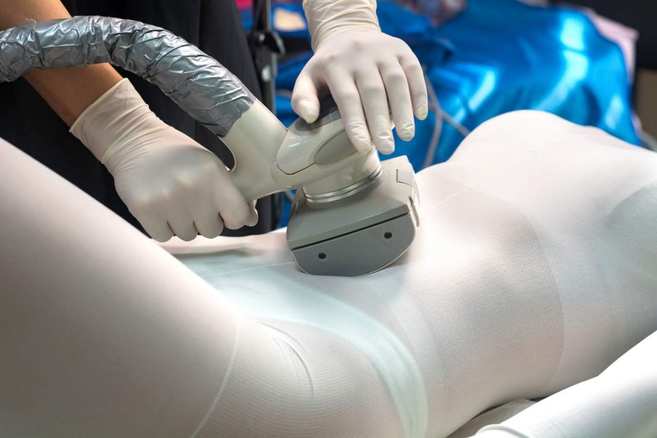 LPG en Arrasate para operación bikini. ¿Es eficaz la técnica estética?