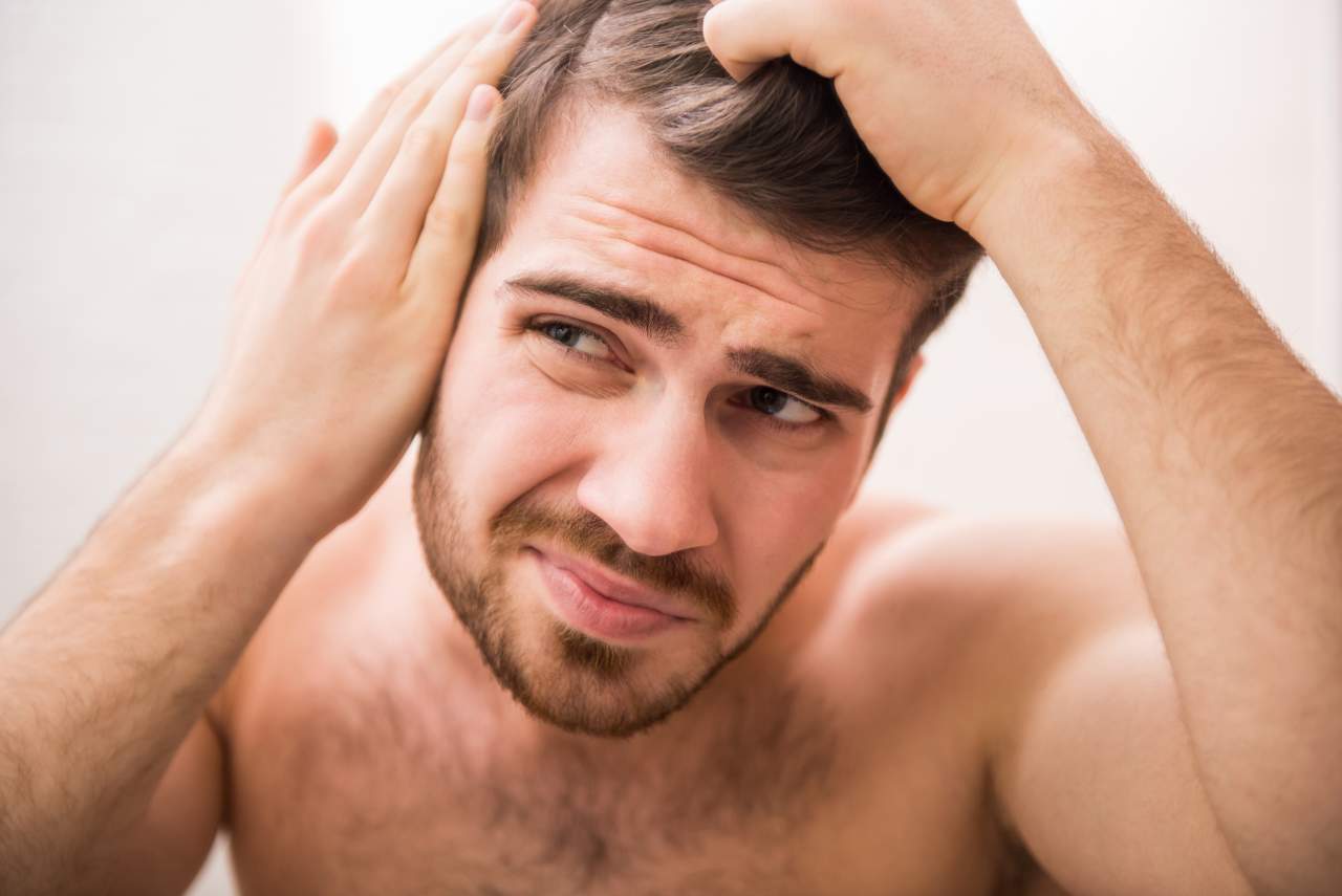 Método DHI por Dr. Bern Barbehito: un 42% de hombres en España son calvos, pero se puede retrasar ese efecto