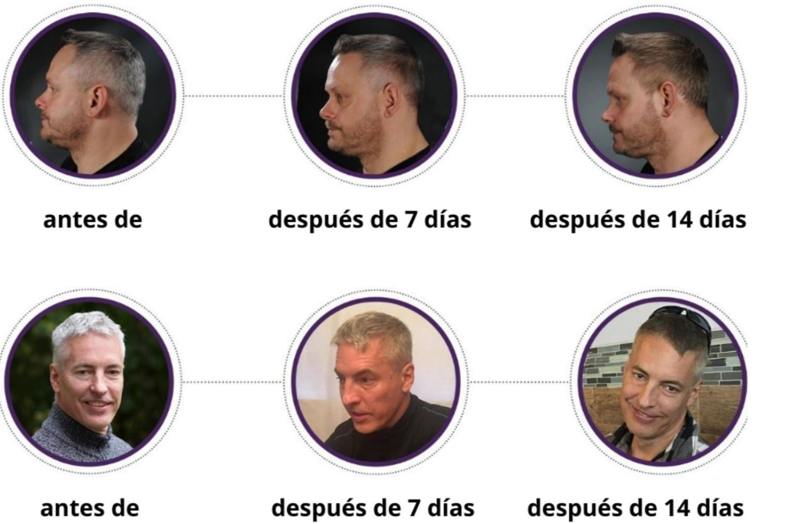 Loción GR-7 Professional: Cómo tapar las canas sin tinte gracias a la loción