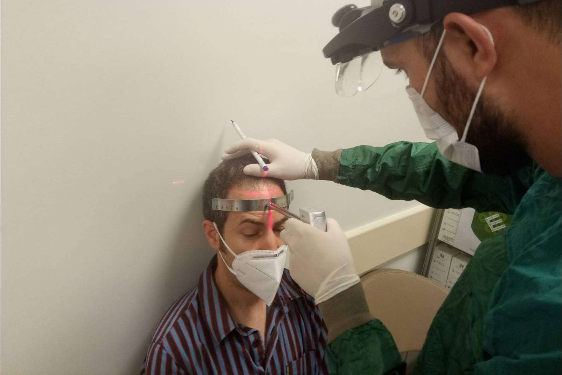 Trasplante capilar en Turquía en la clínica española Fue Hair Transplant System