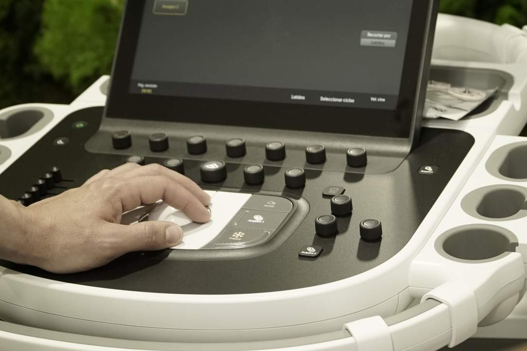 ¿Cómo prevenir patologías cardiovasculares? Escáner médico de detección espectral