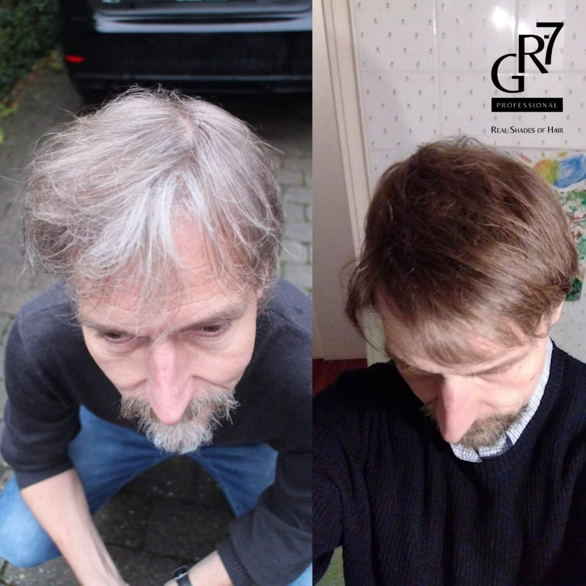 ¿Cómo cubrir las canas? GR-7 es la loción que devuelve la coloración al cabello de forma natural