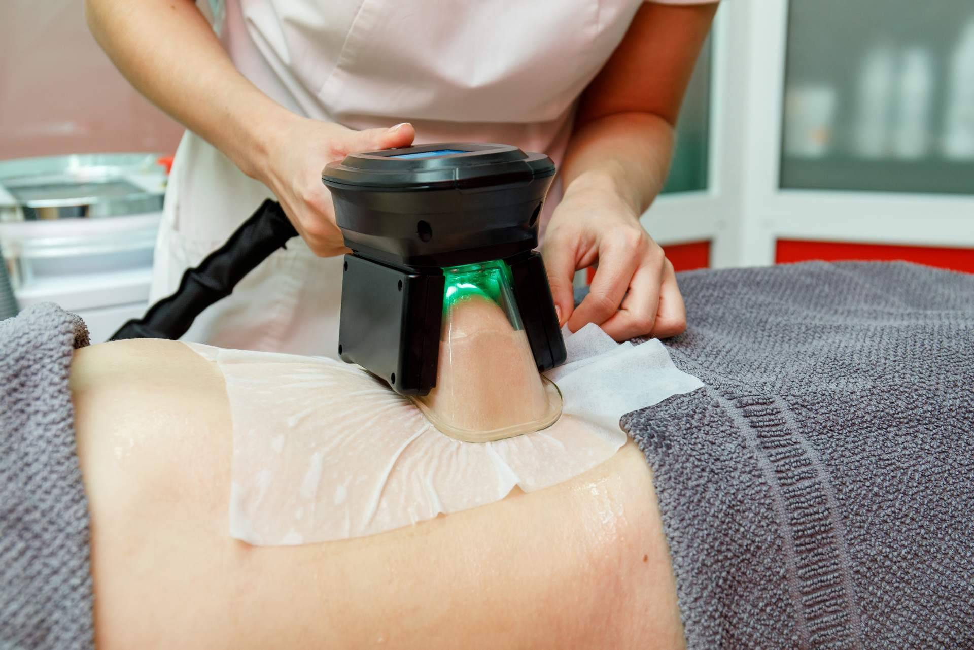Tratamiento de criolipolisis en Boiro de la mano de Alfonsina Uriburu