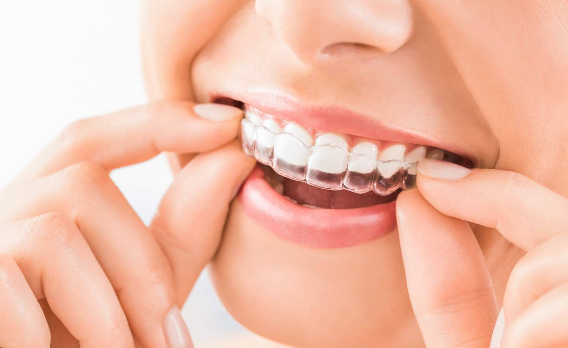 Clínica Dental Heins cuenta con un equipo altamente cualificado para realizar tratamientos de implantes dentales y ortodoncia invisible