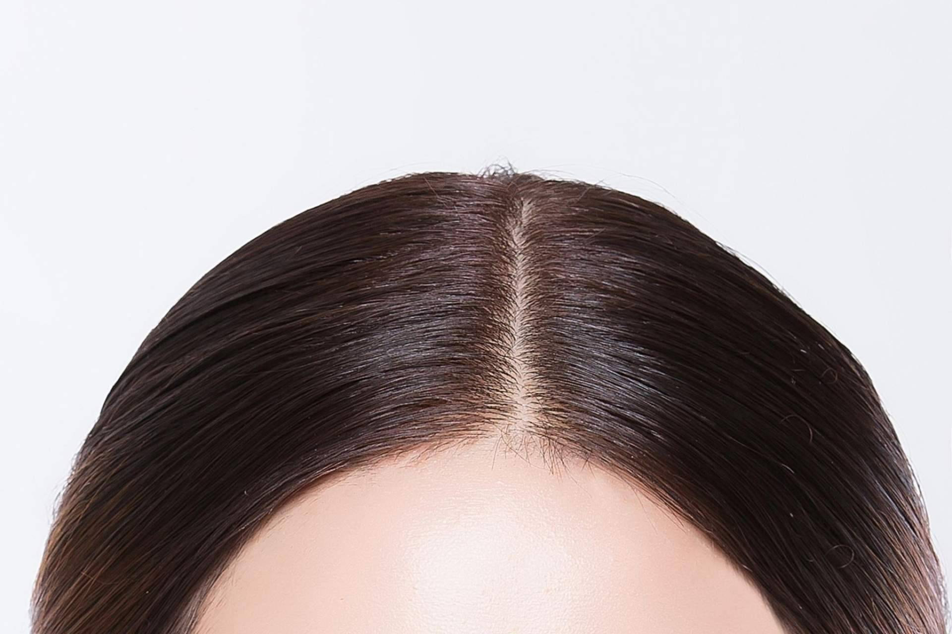 CharoConector ofrece tratamientos para combatir la descamación y caspa y lucir un pelo sano