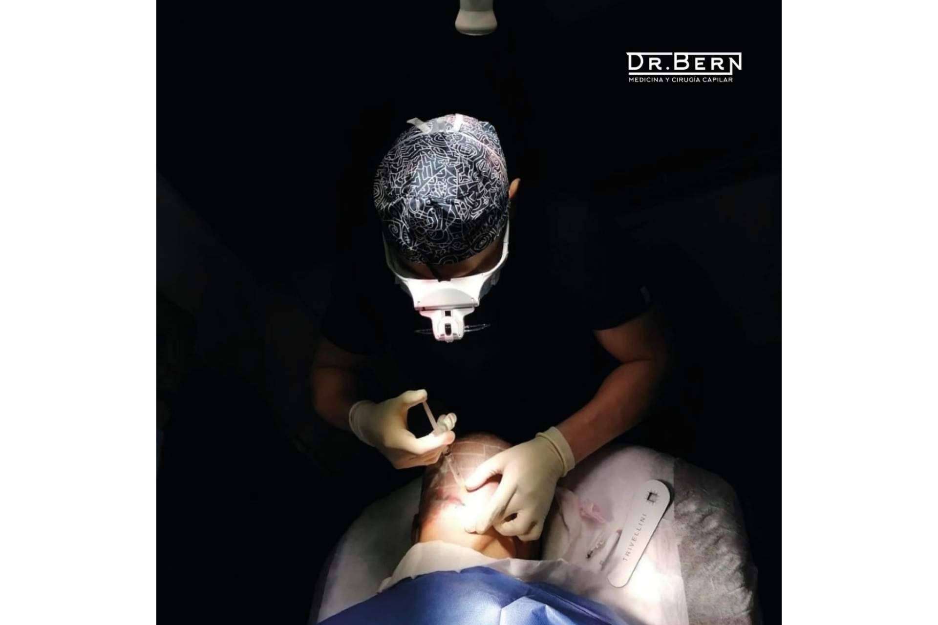 Efluvio telógeno, cuidado capilar y pautas para prevenirlo de la mano del Dr. Franz Joseph Bern Barbehito