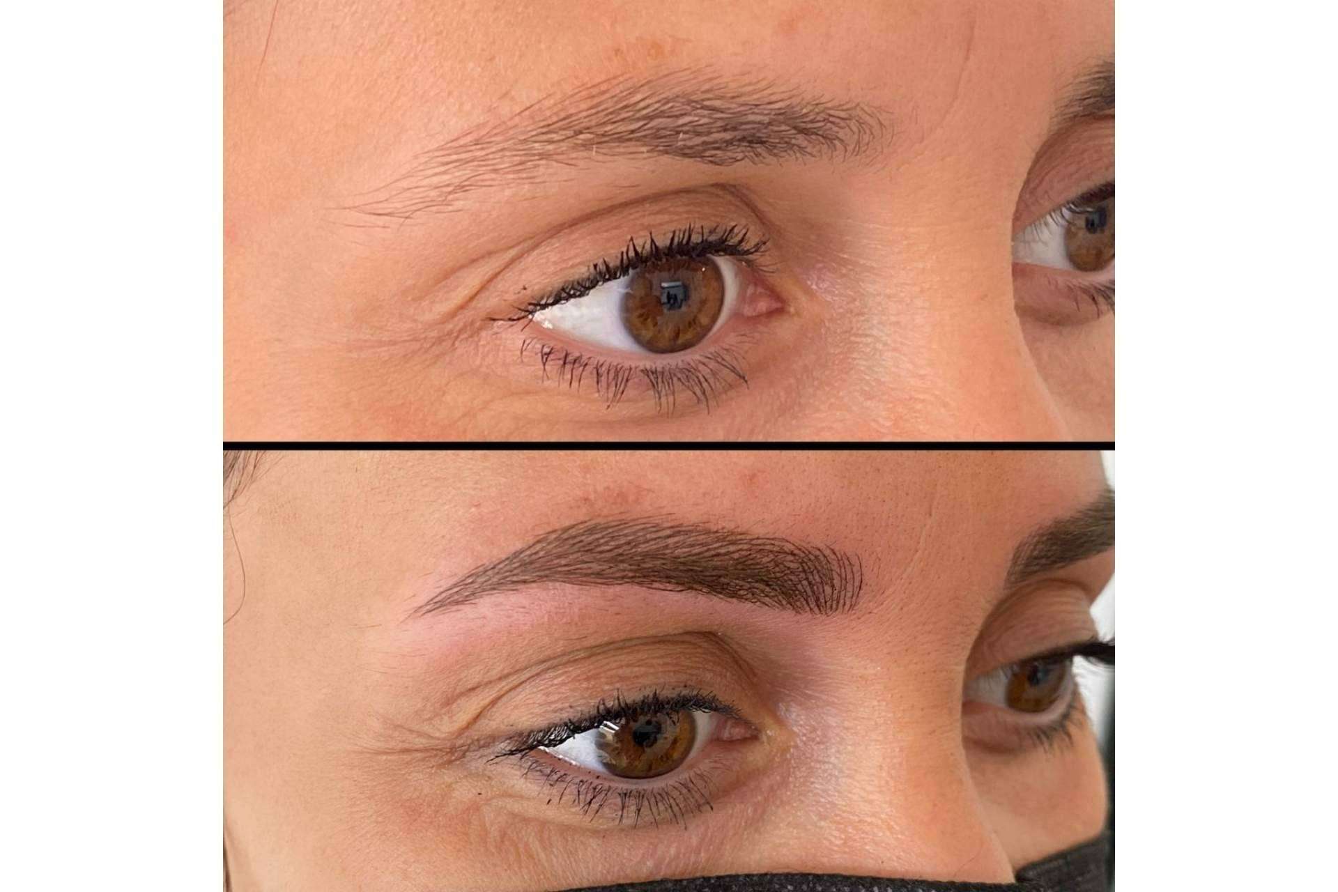 ¿Cómo lucir un rostro siempre perfecto? Microblading de la Dra. Julieta Gil