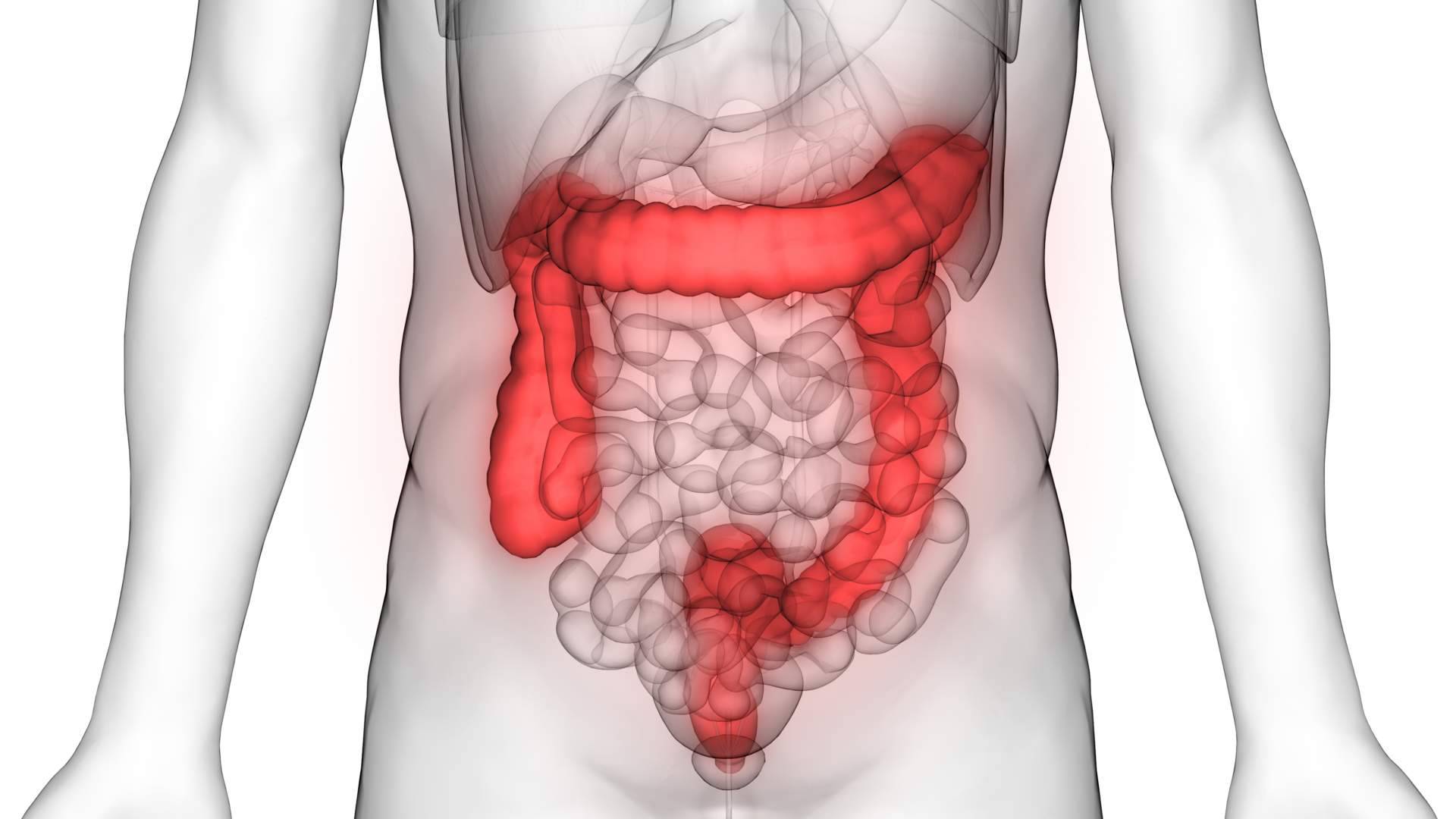 El Dr. Fernando Ruger Viarengo aporta las claves para un diagnóstico y tratamiento adecuado de colon irritable