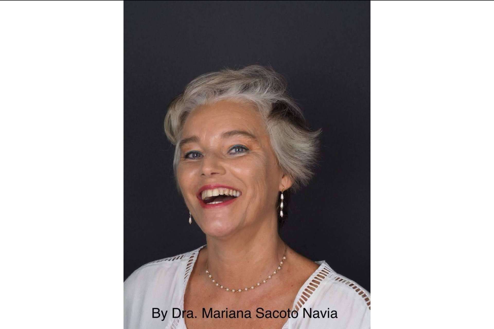 La ortodoncia para diseñar sonrisas, Invisalign®