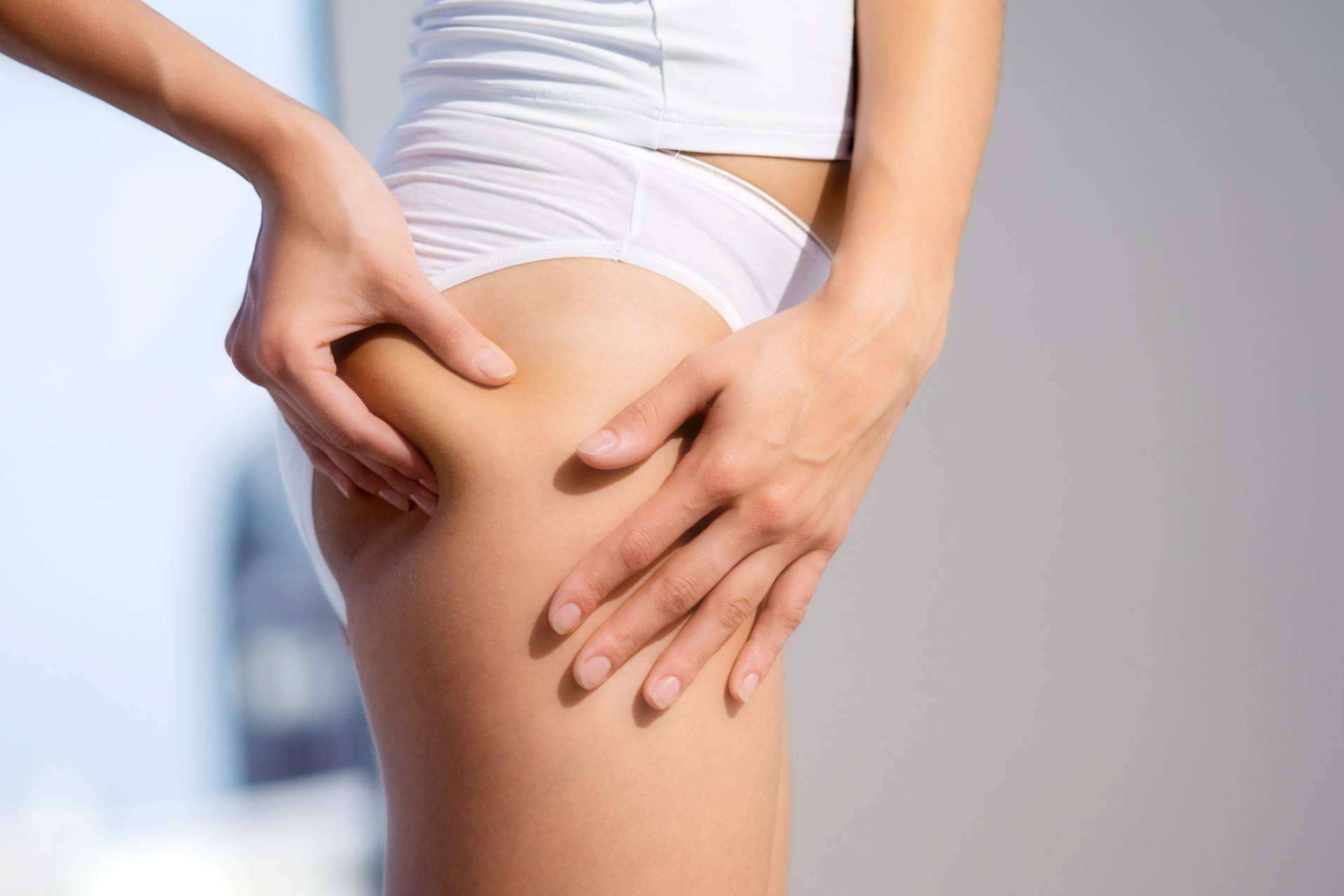 Sincelut Forte, una ayuda para combatir la celulitis de una forma natural