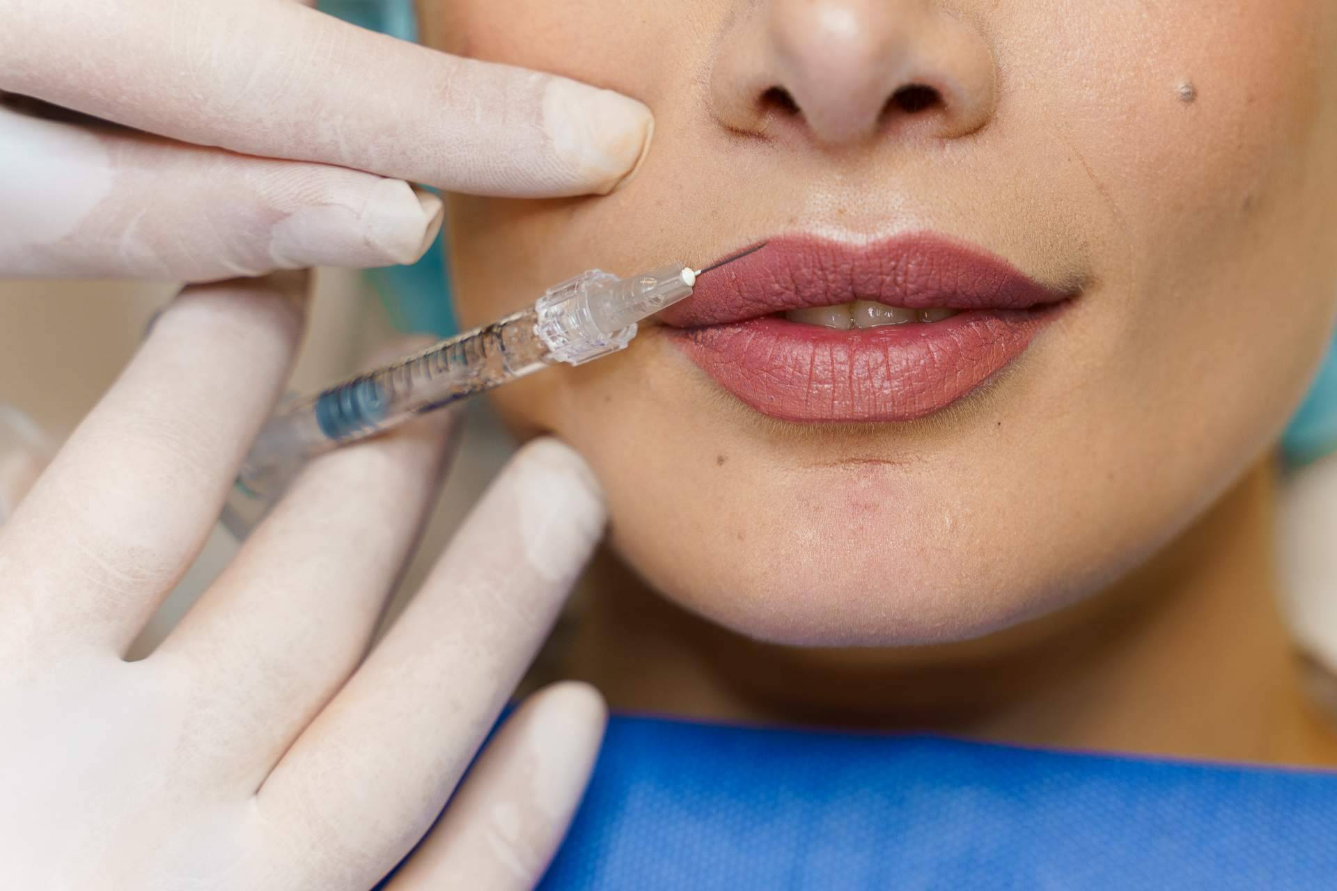 El aumento de labios realizado de Clínicas Be