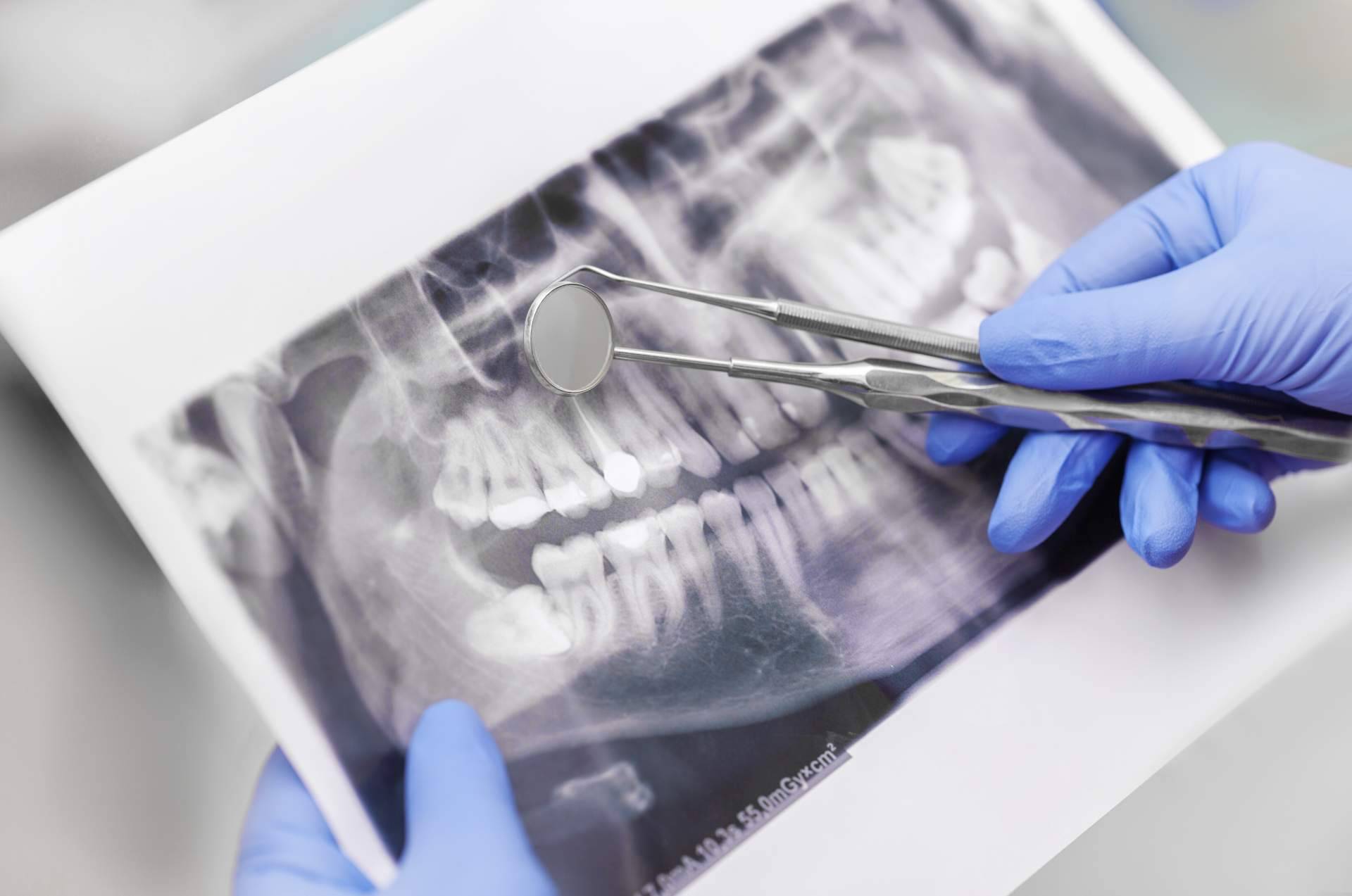 Star Dent, las claves de un servicio técnico dental