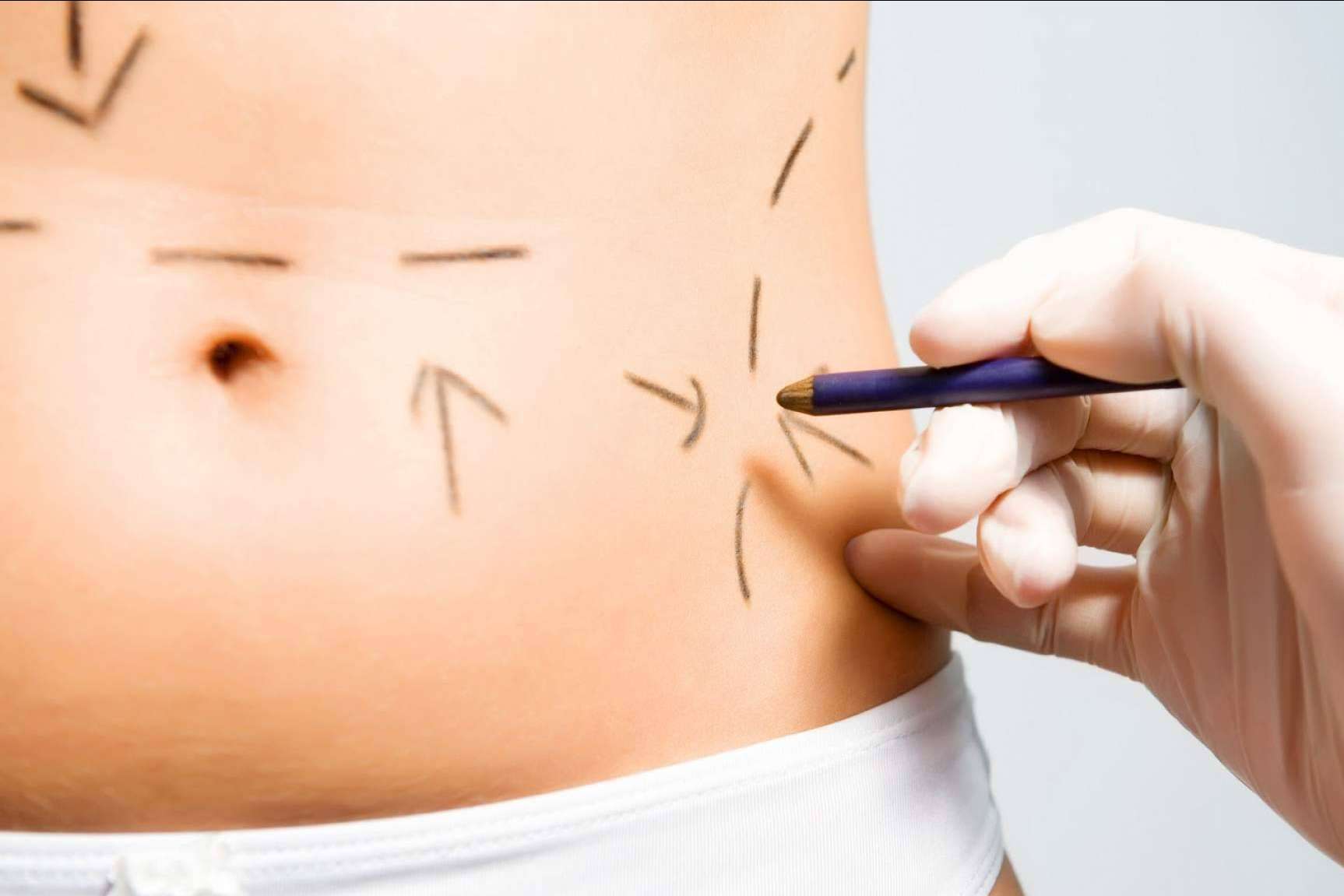 Lucir el cuerpo soñado gracias a los tratamientos de cirugía estética corporal de Clínicas Be