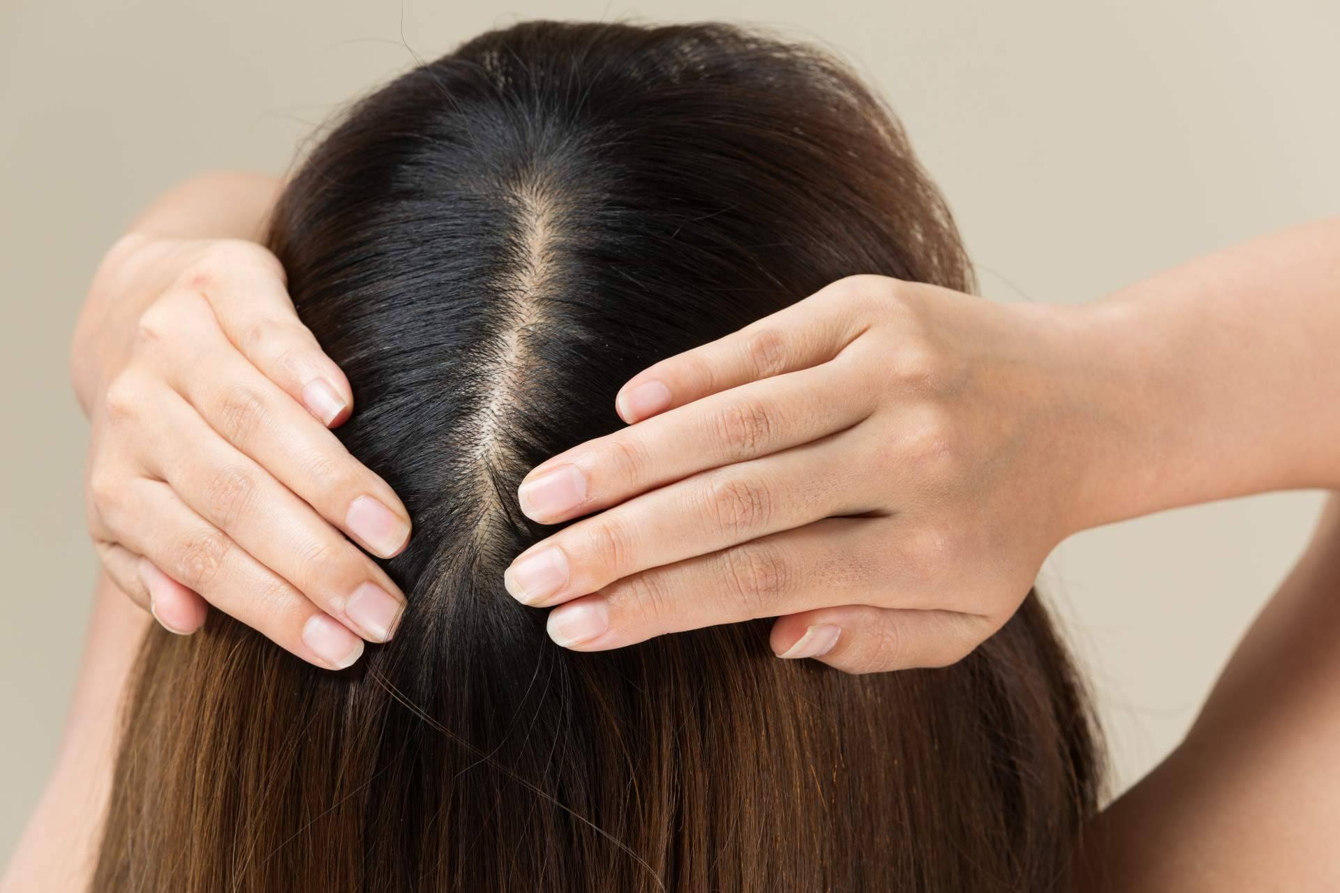Solución MHS-Mesohair de DSD de Luxe evita la caída del cabello y fortalece los folículos