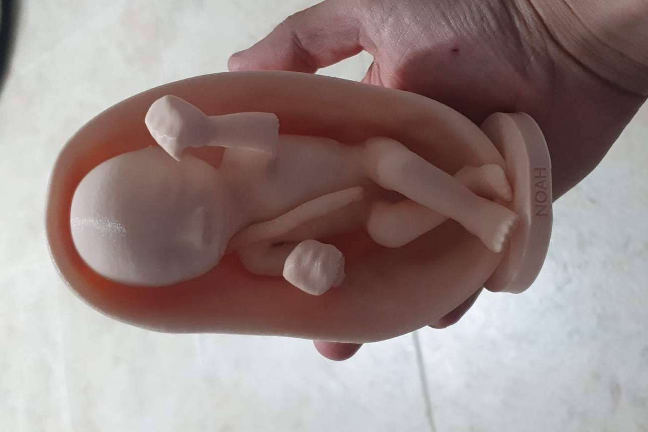 La impresión 3D gana presencia en muchos sectores del mercado, por Villa Print 3D