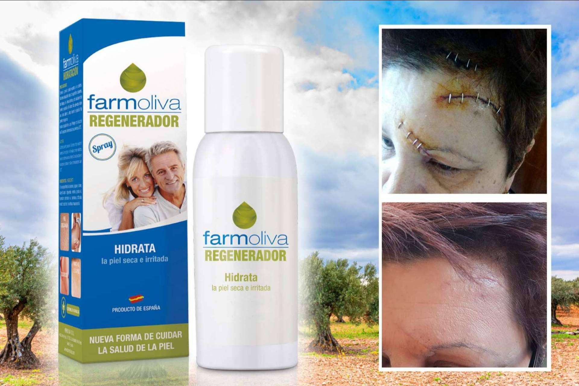 El spray de Farmoliva que ayuda a la piel a regenerarse de manera natural para mantenerla sana, Farmoliva Regenerador
