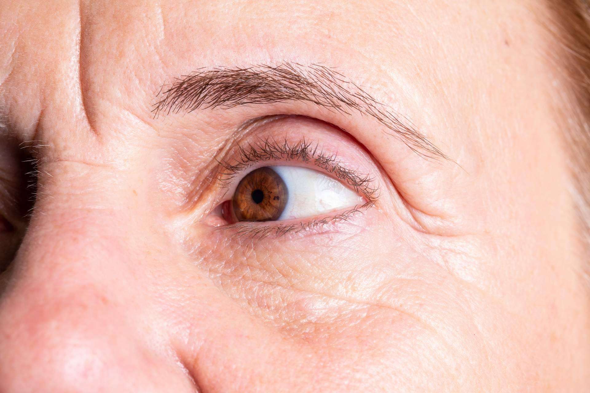 Dr. Carlos Zito, profesional en medicina estética de tratamientos de ojeras