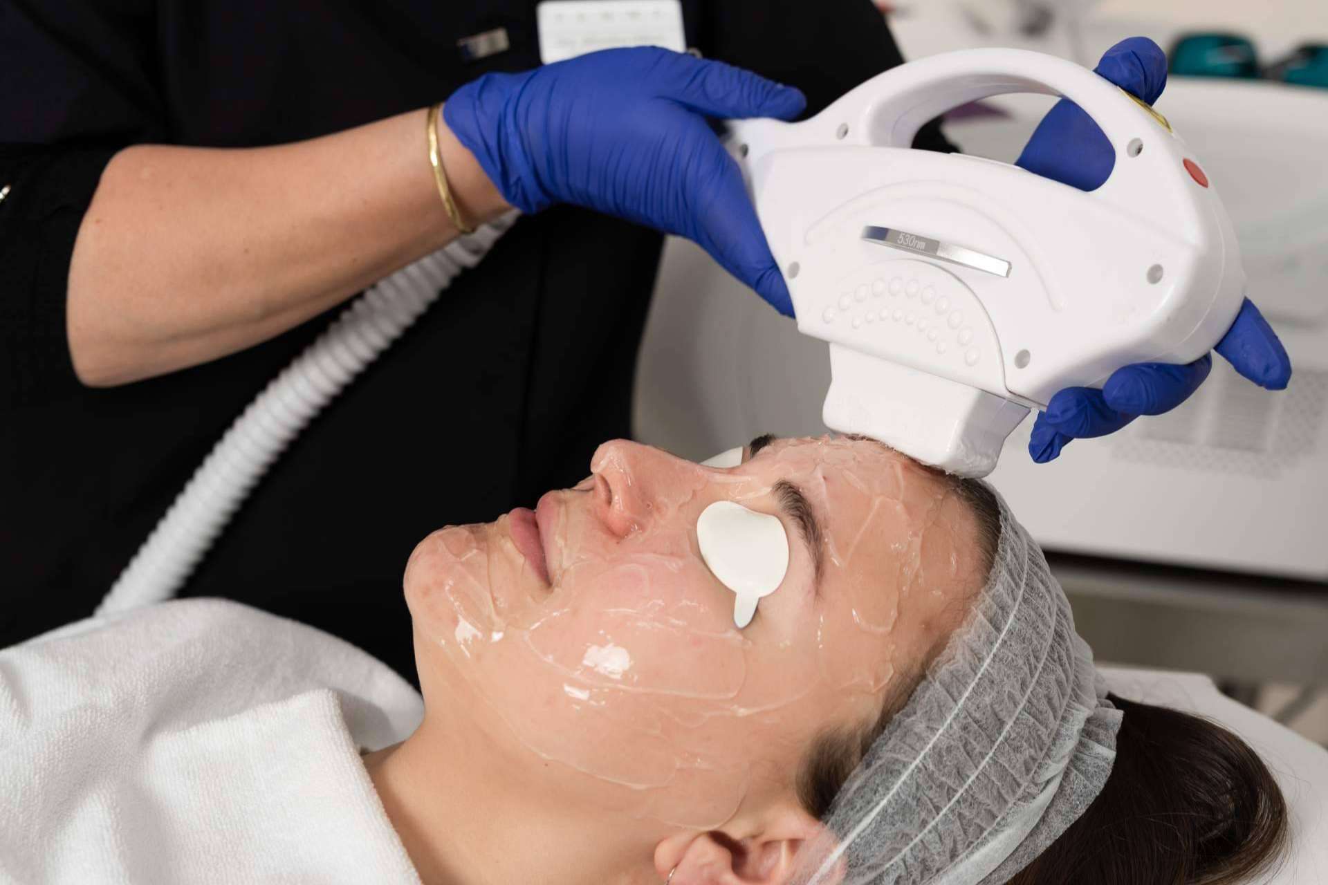 El tratamiento de luz pulsada permite eliminar las manchas solares de la cara, cuello y escote