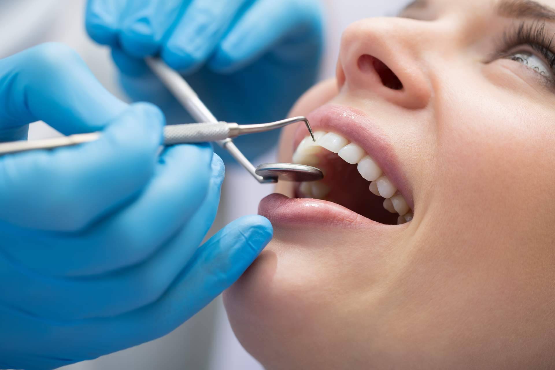 Ortodoncia Insignia, una técnica a medida para la dentadura de un paciente en Clínica Dental Sonrisas