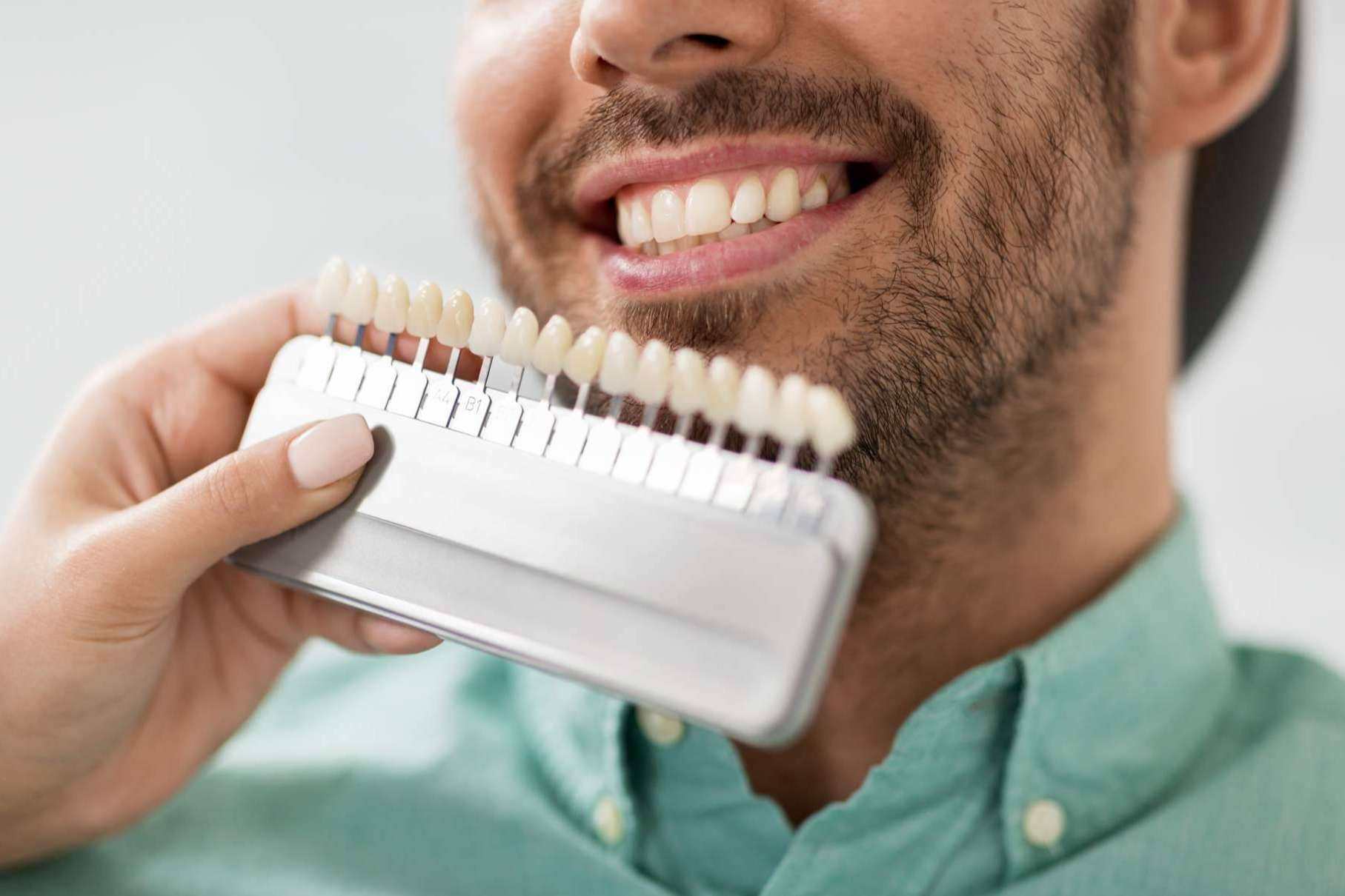 El blanqueamiento dental en casa refuerza los resultados del procedimiento clínico