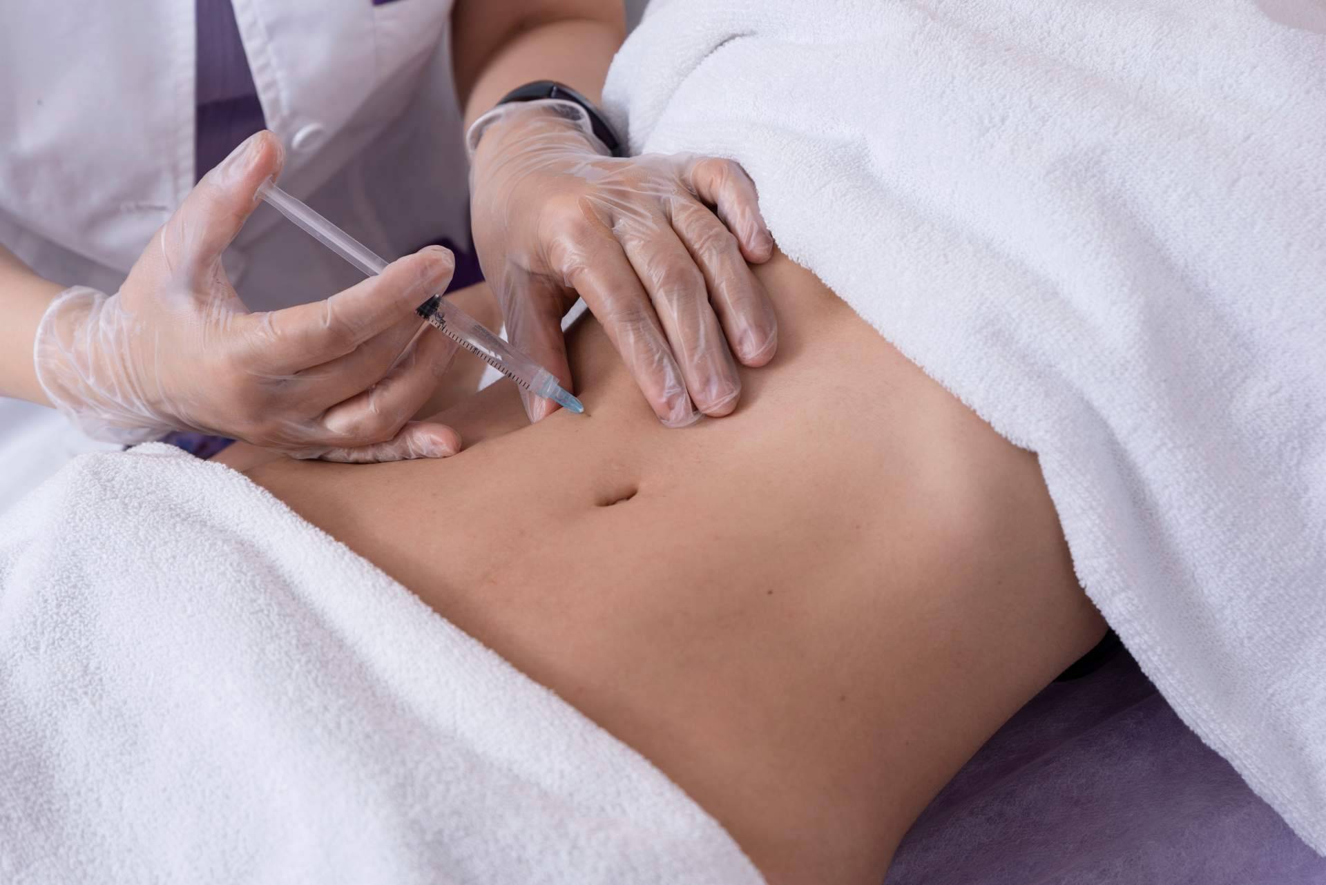 Las ventajas de realizarse la mesoterapia corporal, con Alluring Clinic