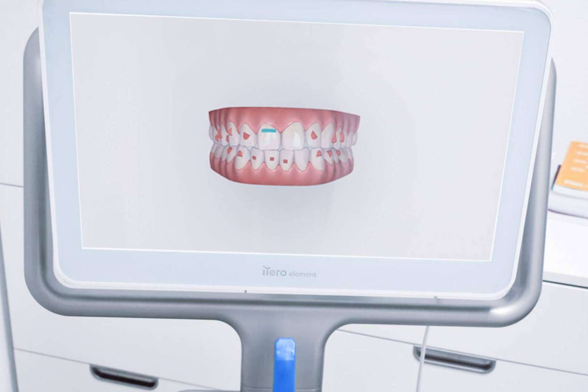 La alternativa perfecta a los brackets, la ortodoncia invisible Invisalign