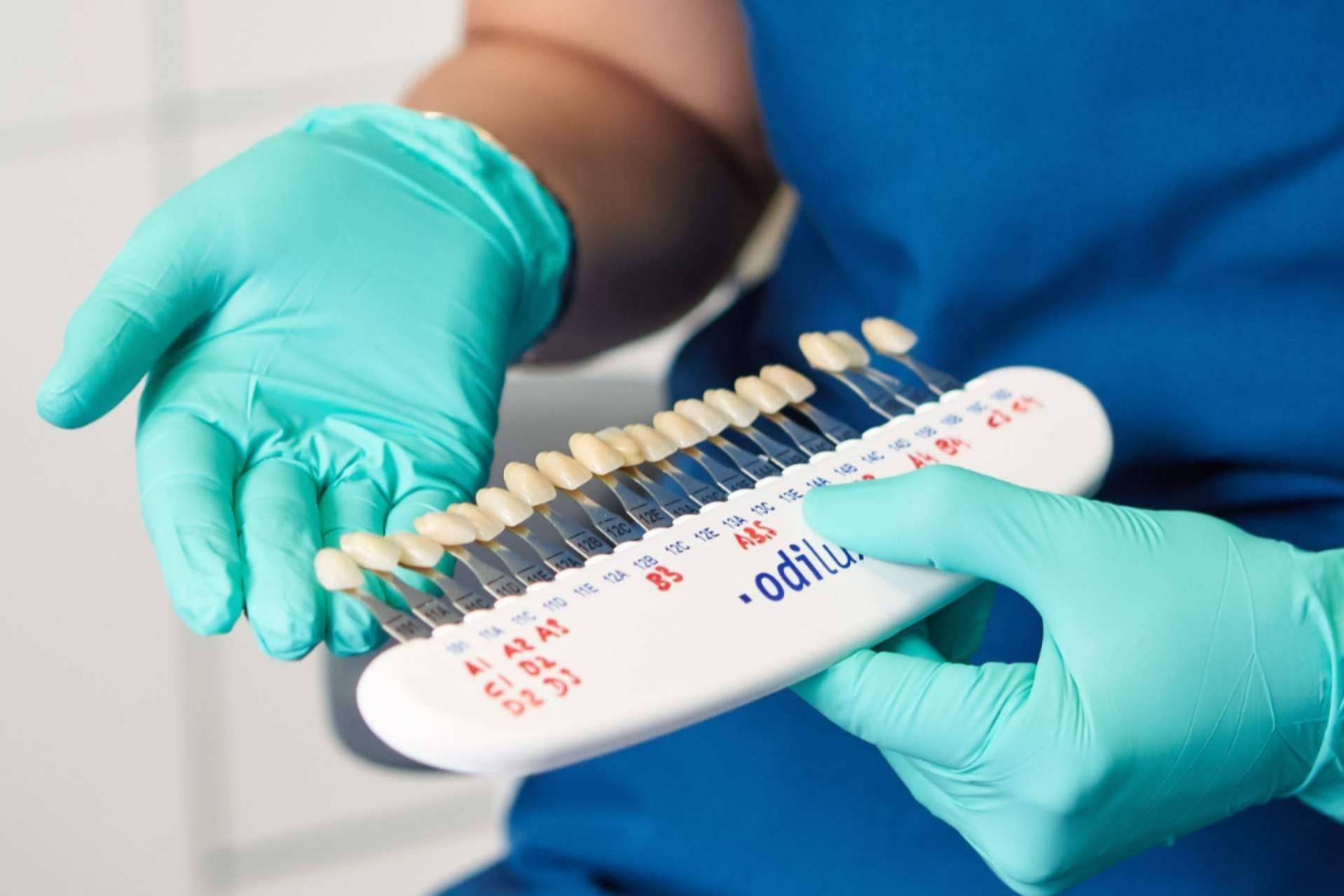 Bordonclinic sobre los diferentes tipos de blanqueamientos dentales