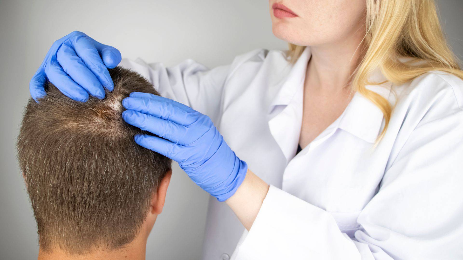 ¿La alopecia por tiña del cuero cabelludo puede ser contagiada por los perros?