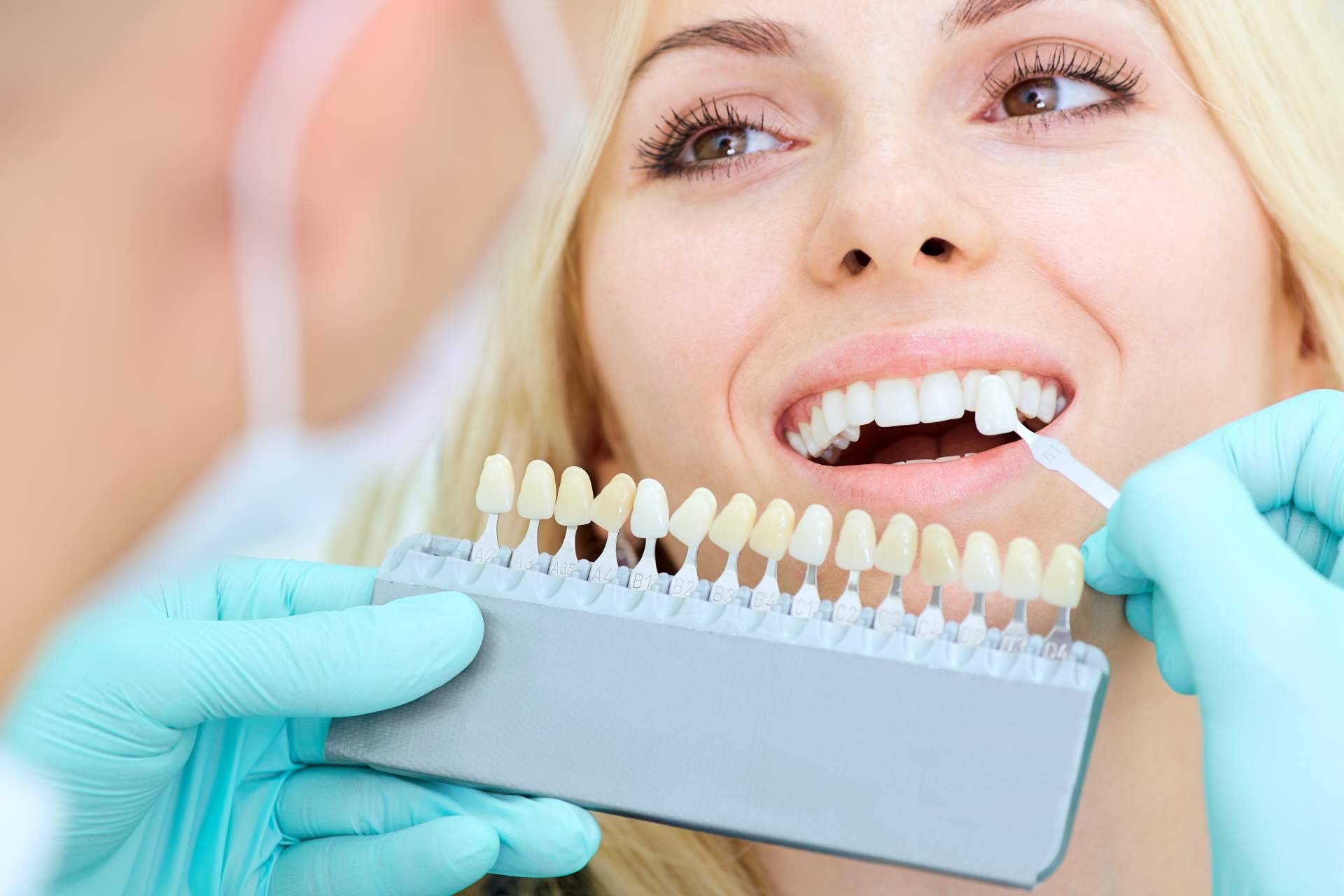 El tratamiento de carillas dentales se lleva a cabo en esta clínica dental de Chamartín
