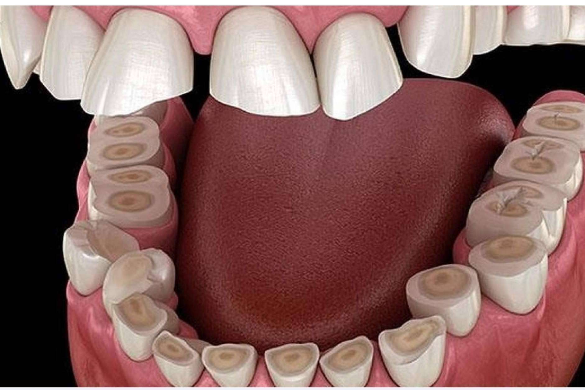 Prevenir el sangrado de encías, con ayuda de Dentinova