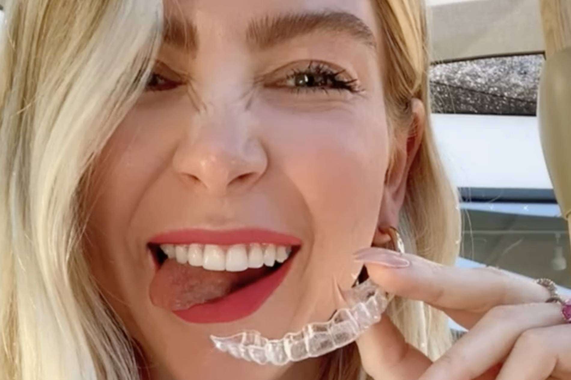 El precio especial de la Clínica Dental Ruiz de Gopegui para aquellos pacientes que quieran la ortodoncia invisible Invisalign