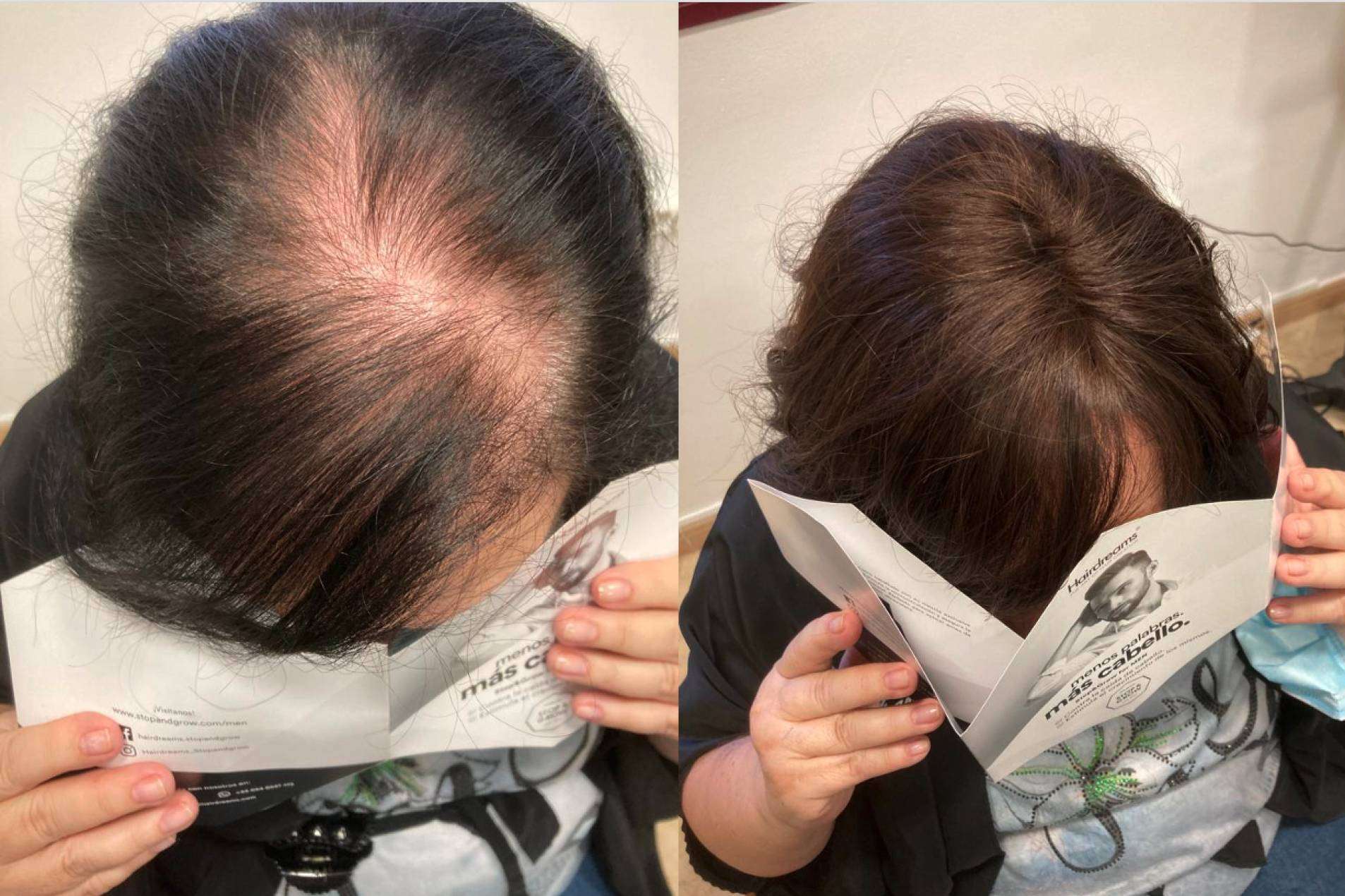 Mar Chancosa pone a disposición las extensiones de cabello 100% de cabello natural de Hairdreams