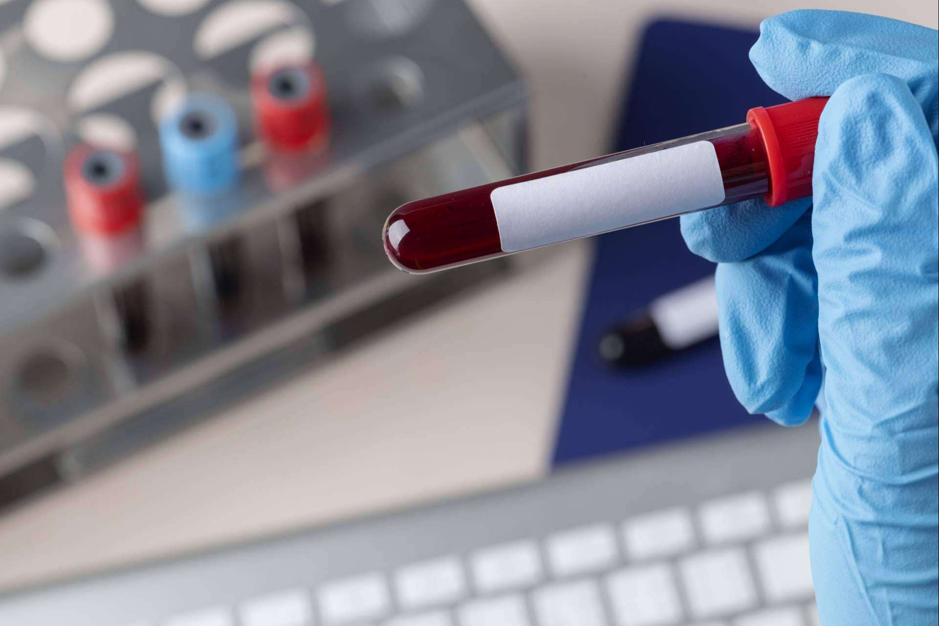 Crezen sobre la importancia de las pruebas genéticas en la salud actual