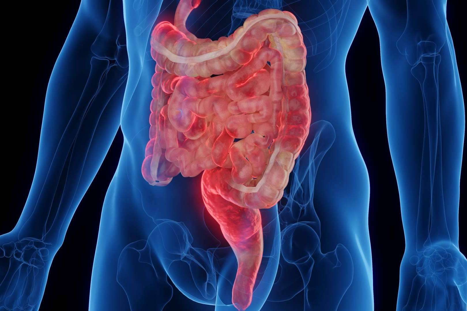 La patología de la enfermedad de Crohn
