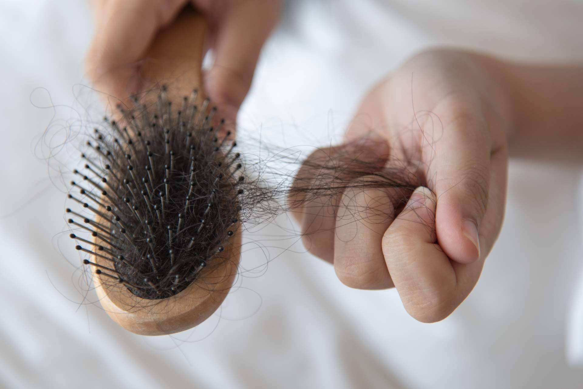 Capilar Innovation Clinic, especialistas en cualquier tipo de alopecia femenina
