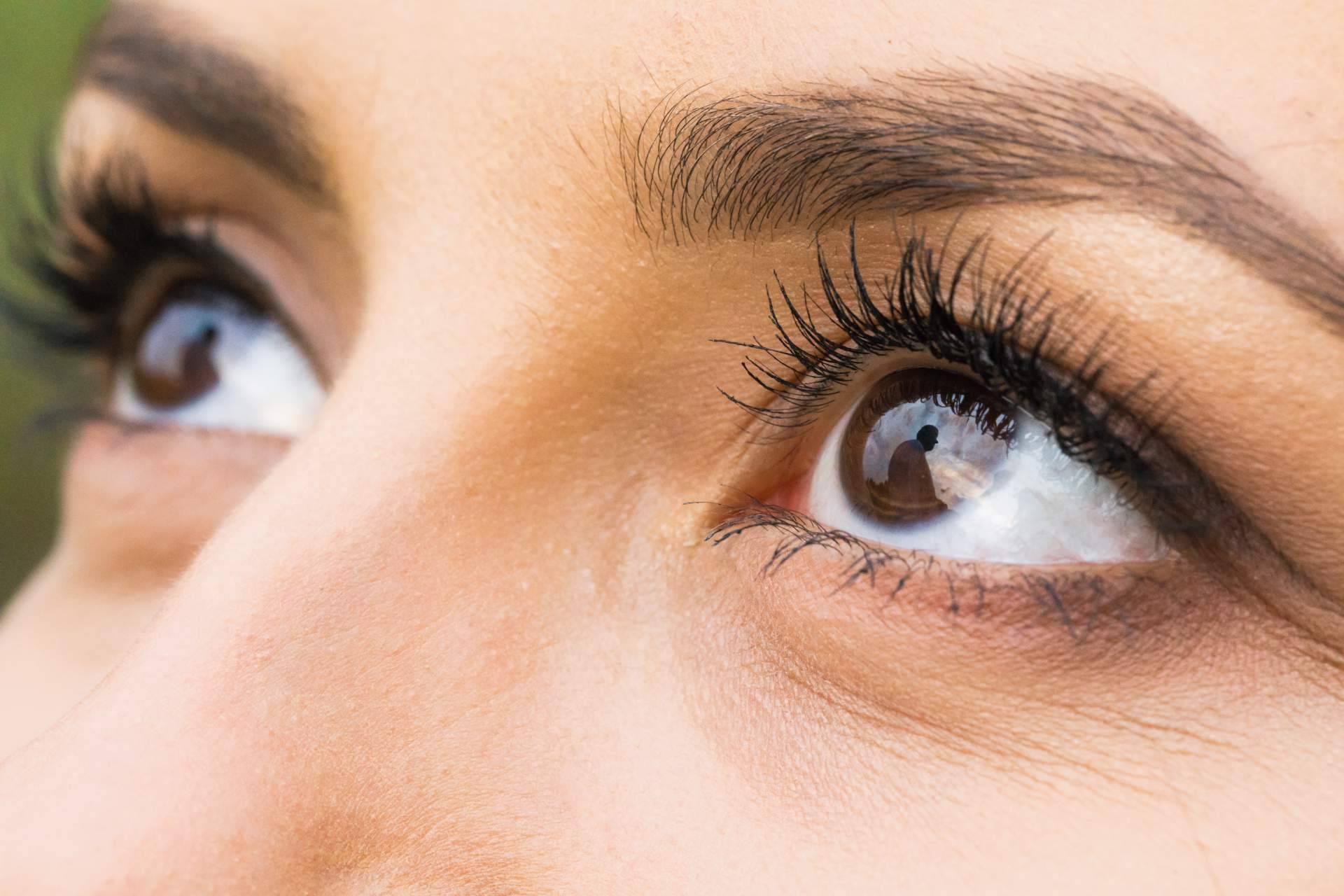 Conseguir una mirada cautivadora con la tendencia de 'foxy eyes' en medicina estética