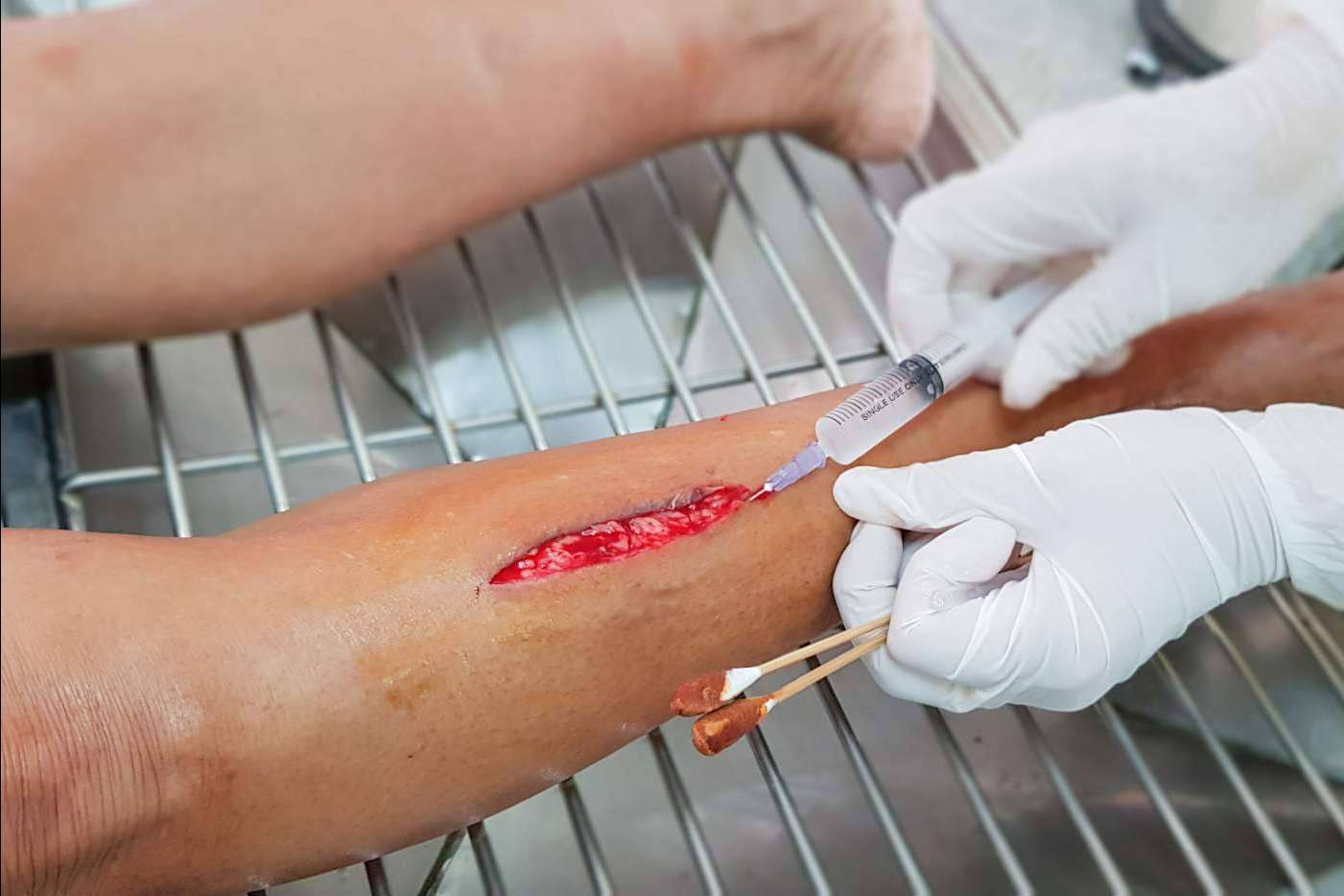 El próximo 6 de Febrero de 2023 se realizará una formación gratuita sobre sutura online para profesionales sanitarios de la mano de Enfermería Evidente
