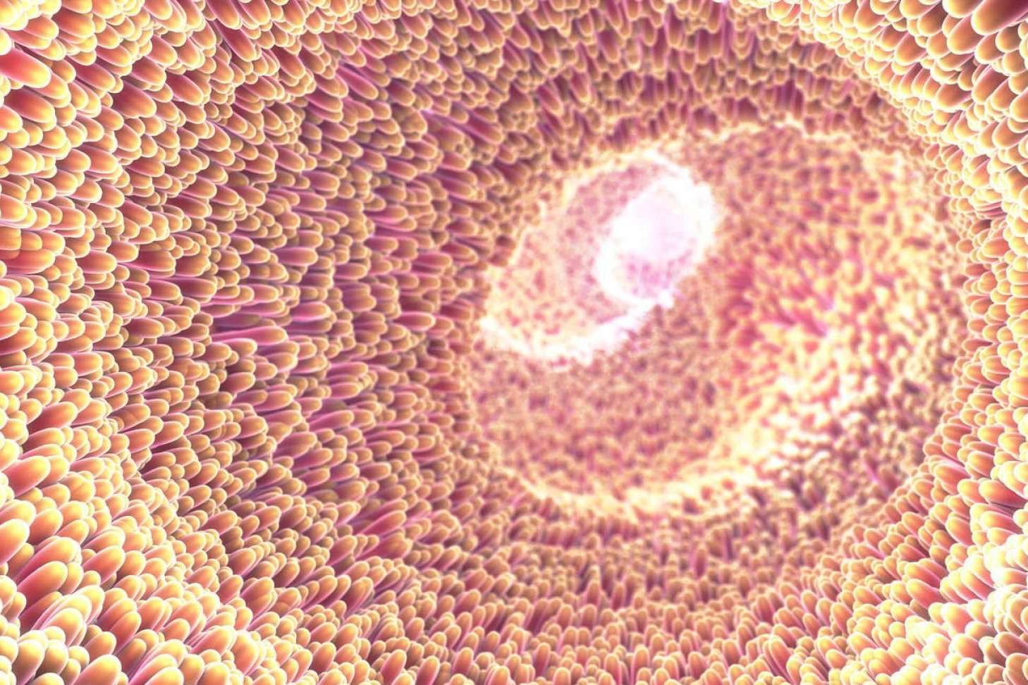 Autoinmunidad que empieza en el intestino, lo aclara el Dr Fernando Ruger Viarengo, director de Clínica Umebir