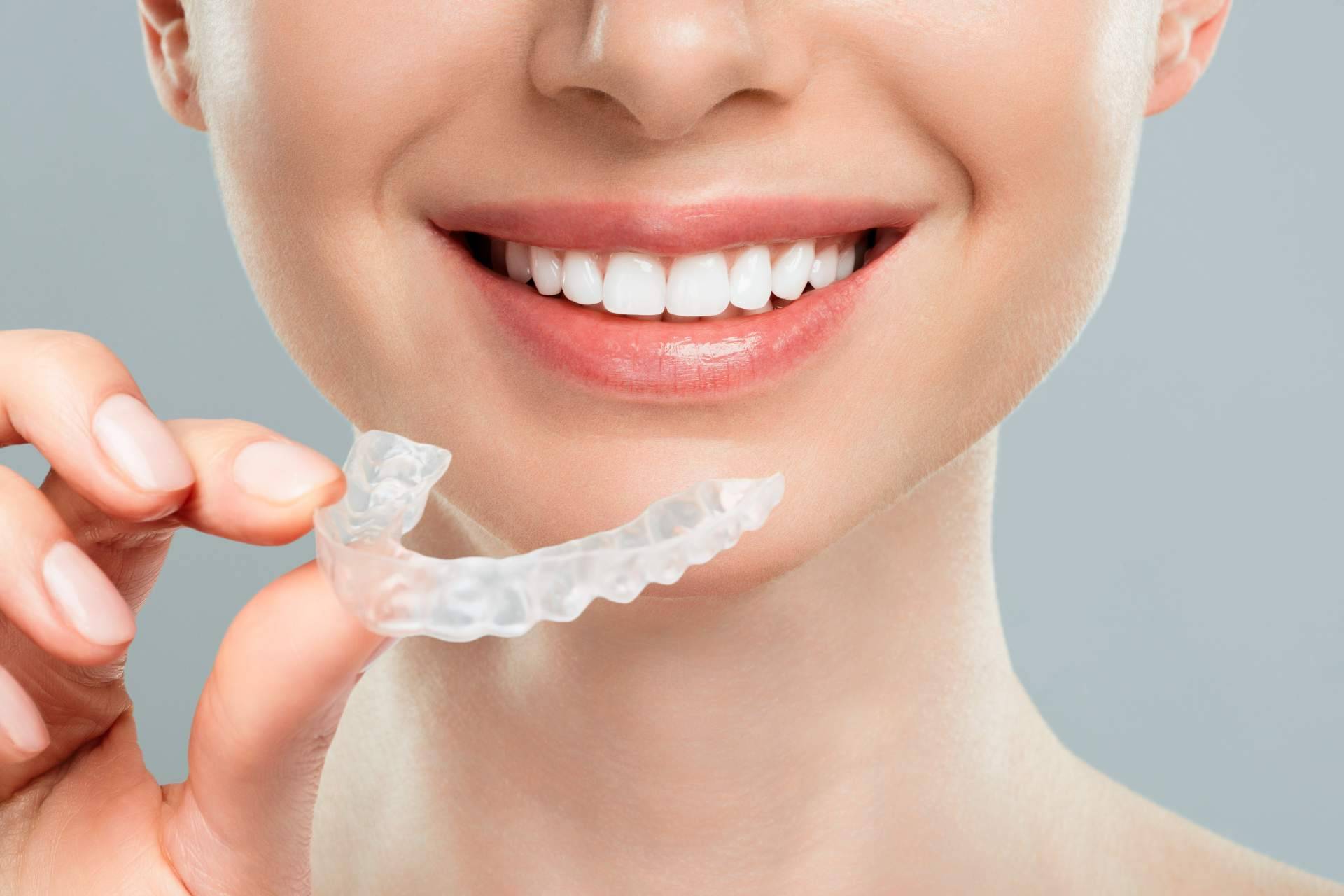 Lograr una sonrisa perfecta con los profesionales de la clínica Carlos Saiz Smile