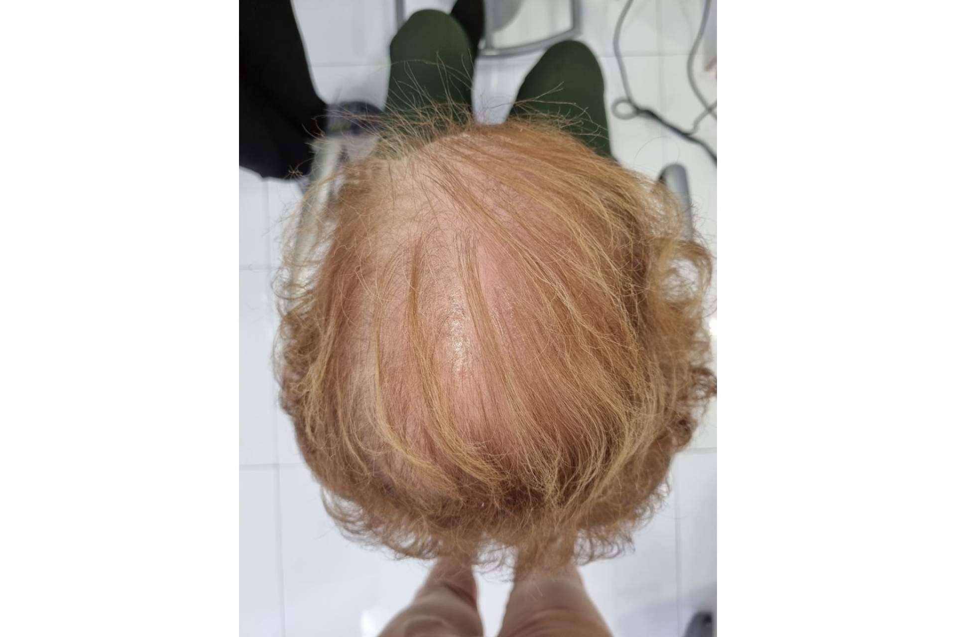 ¿Qué son las fibras capilares?, explicado por Lion Hair