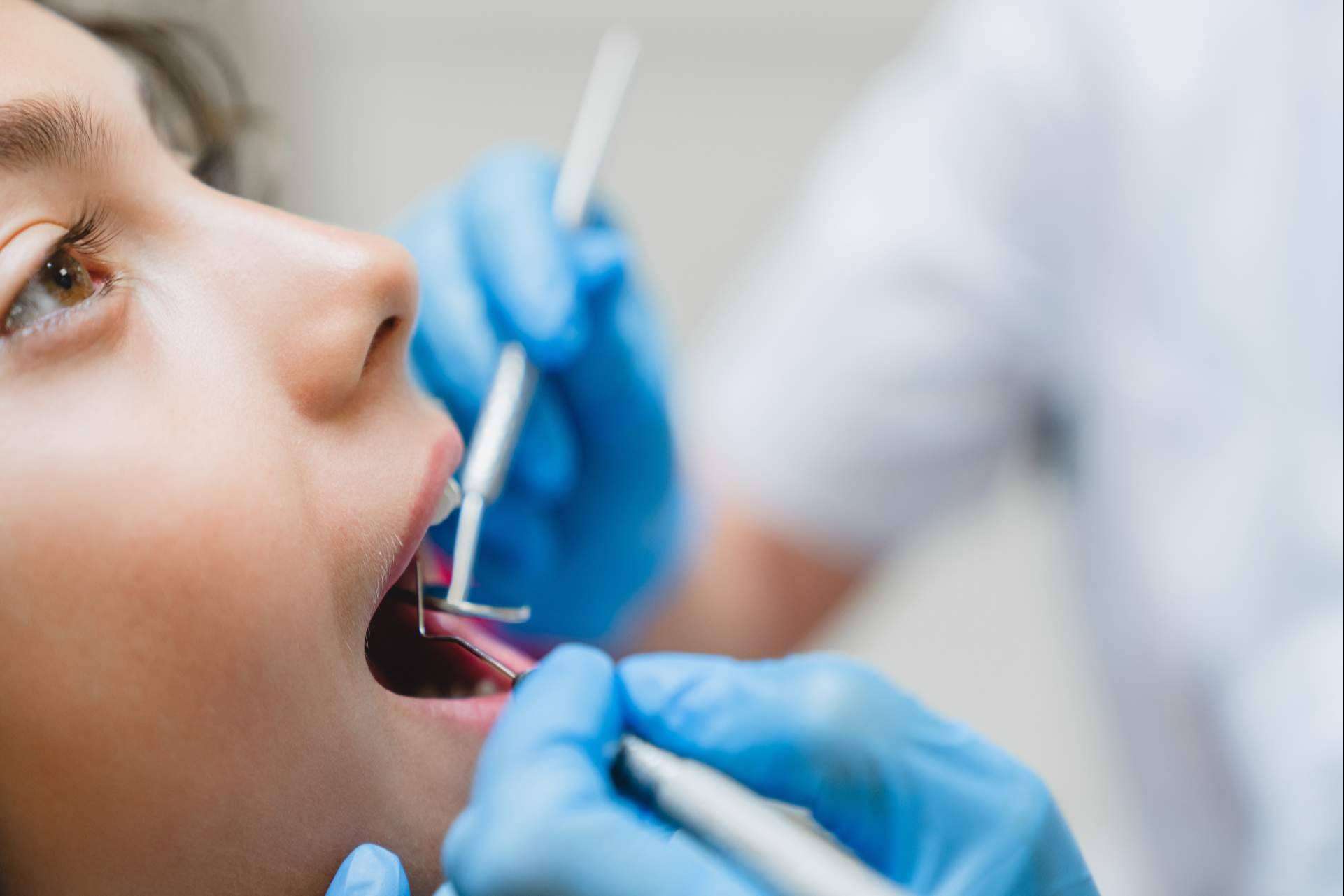 Por qué es importante la dieta en la salud bucodental para la prevención de las caries