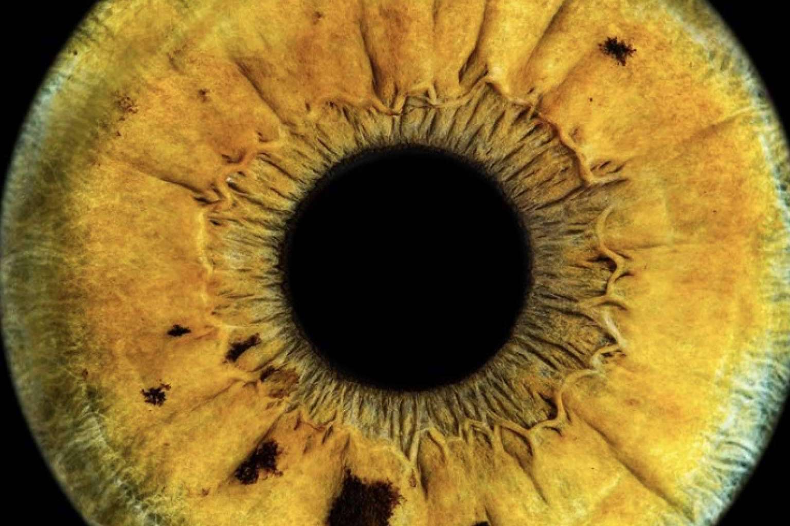 Eyecos, nueva técnica fotográfica de alta definición del iris