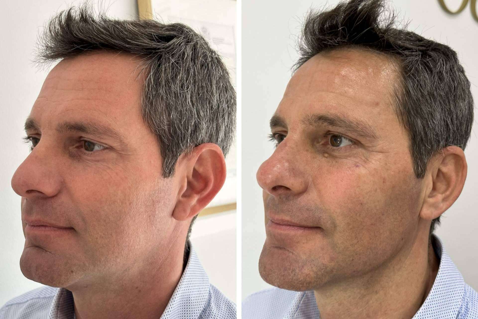 Los tratamientos faciales de Clínica VISO permiten a las personas mejorar su apariencia