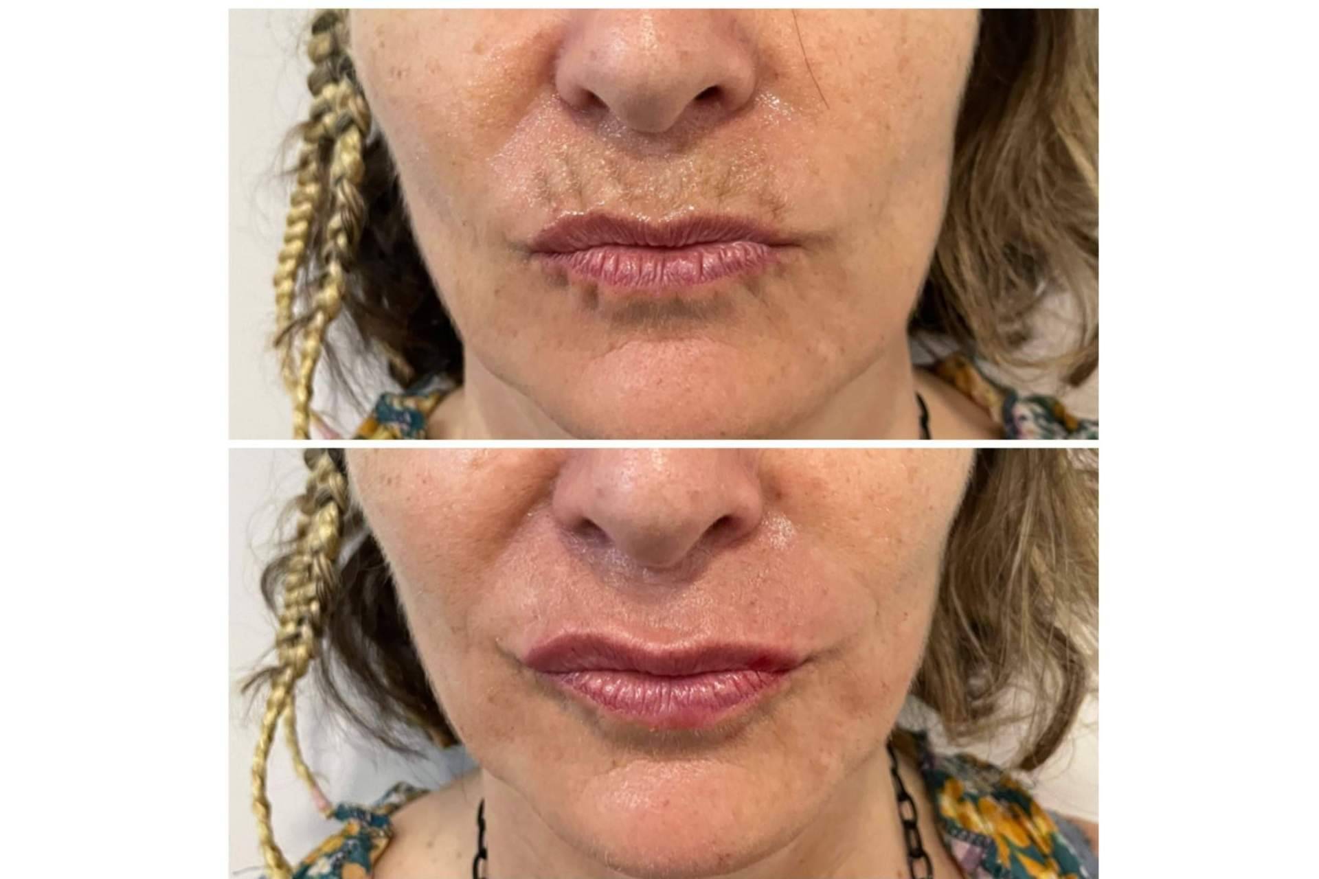 Clínica estética Cecilia Arthur, especialistas en blanching
