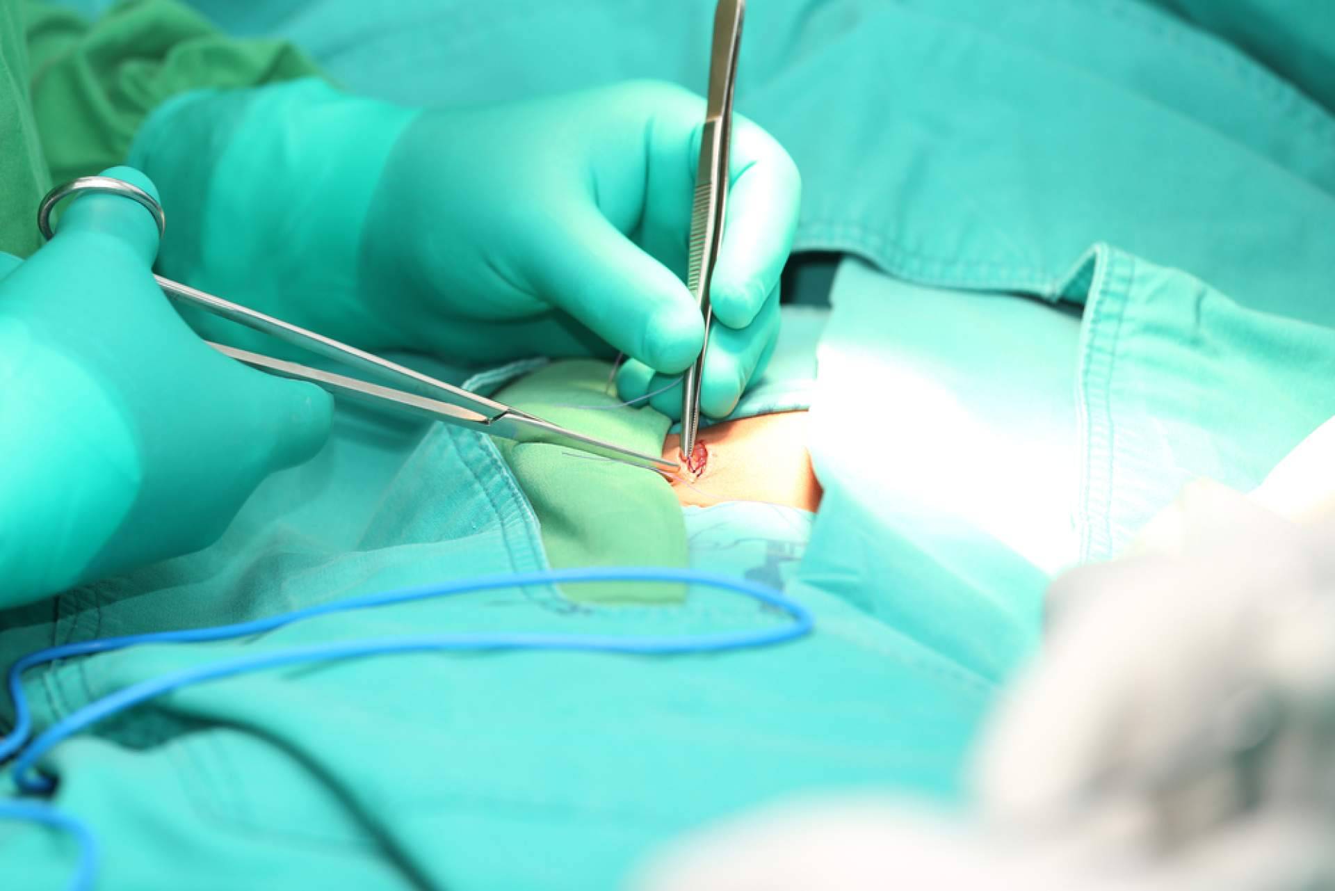 Resolviendo dudas sobre la cirugía de hernia inguinal, con el Dr. Javier Martínez Pascuas